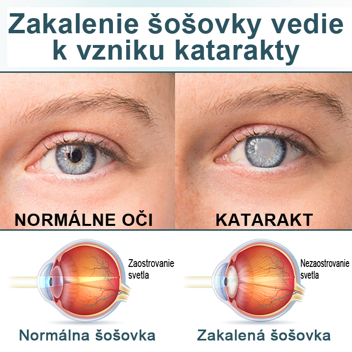 Timilk® OptiFusion Nano očné kvapky Essence💥