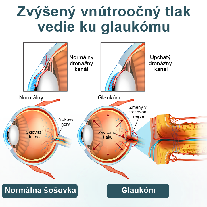Timilk® OptiFusion Nano očné kvapky Essence💥