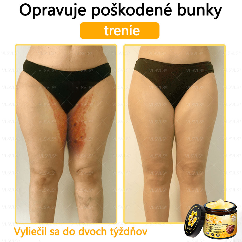 VLSVLS™ Obnovujúci krém na pleť so včelím jedom💥💥💥