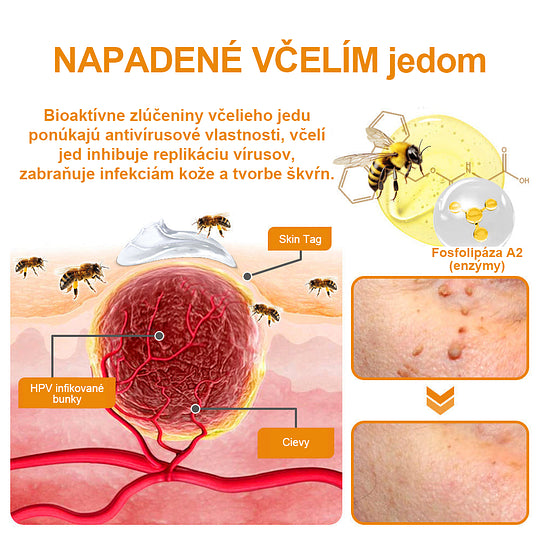 🔥Vsoxa™ Krém na odstránenie bradavíc a krtkov s obsahom včelieho jedu (zľava 80%)