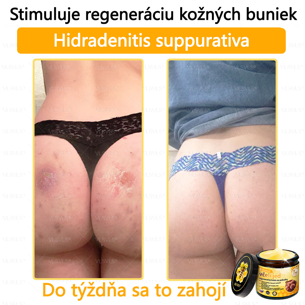 VLSVLS™ Obnovujúci krém na pleť so včelím jedom💥💥💥