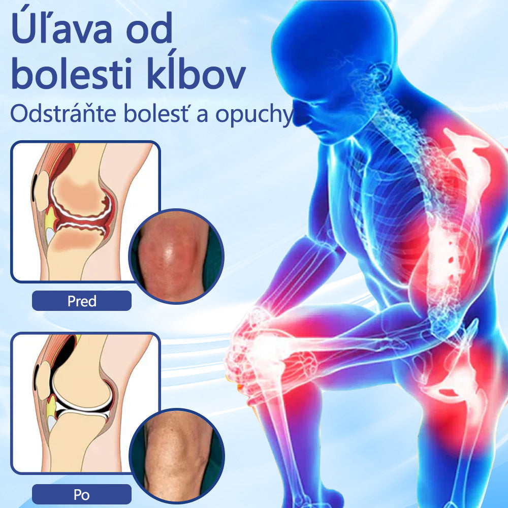 ✅ Schválené ÚVZ SR: Ourlyard® Magnéziový krém na hojenie bolesti kostí (liečba artritídy, neuropatie, reumatických ochorení, svalových kŕčov, zášklbov a športových zranení)
