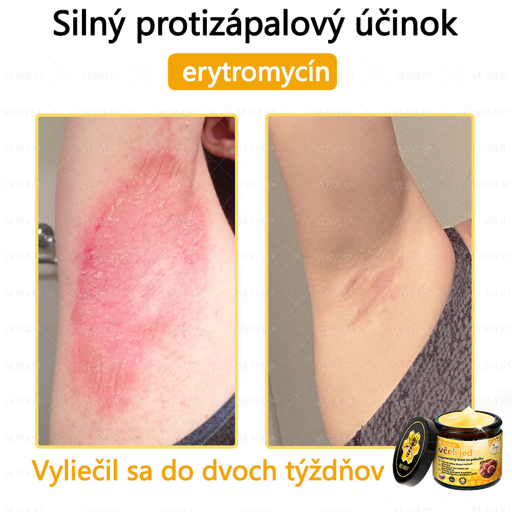 VLSVLS™ Obnovujúci krém na pleť so včelím jedom💥💥💥
