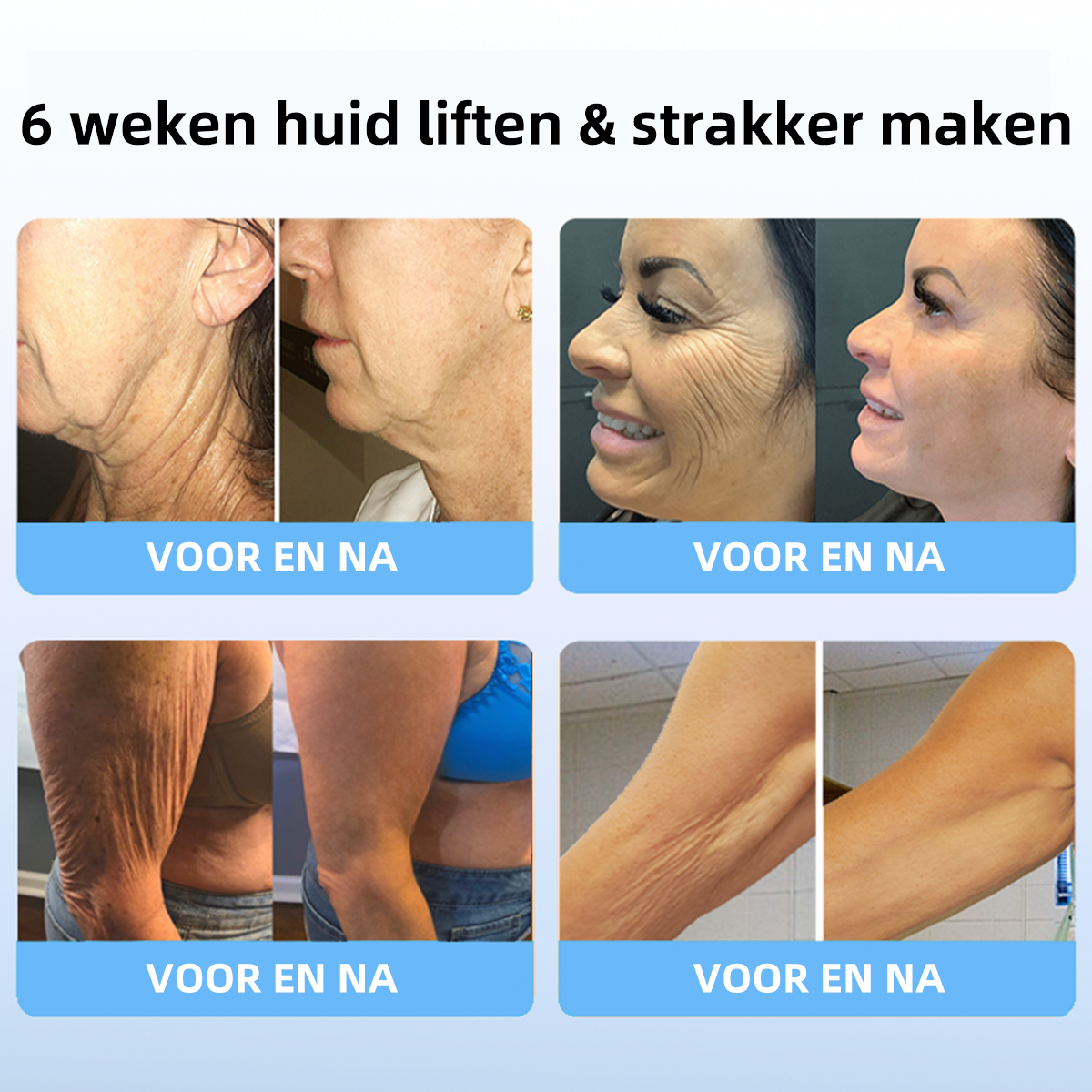 Vyhľadávané produkty! POSLEDNÝ DEŇ VÝPREDAJA: 𝟕5% zľava 🎉Fubsta® Advanced Firming & Wrinkle Reducing Cream: obnovuje pružnosť pokožky - 2024🔥🔥🔥🥰