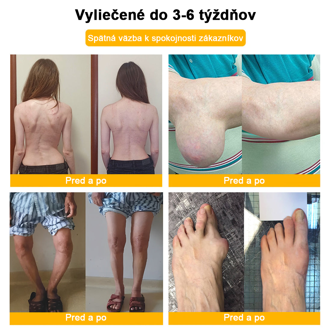 𝑭𝑨𝑻𝑶𝑵𝑮® Krém proti bolesti a hojeniu kostí zo včelieho jedu (výhradne pre seniorov a na odporúčanie NVOC)🧨