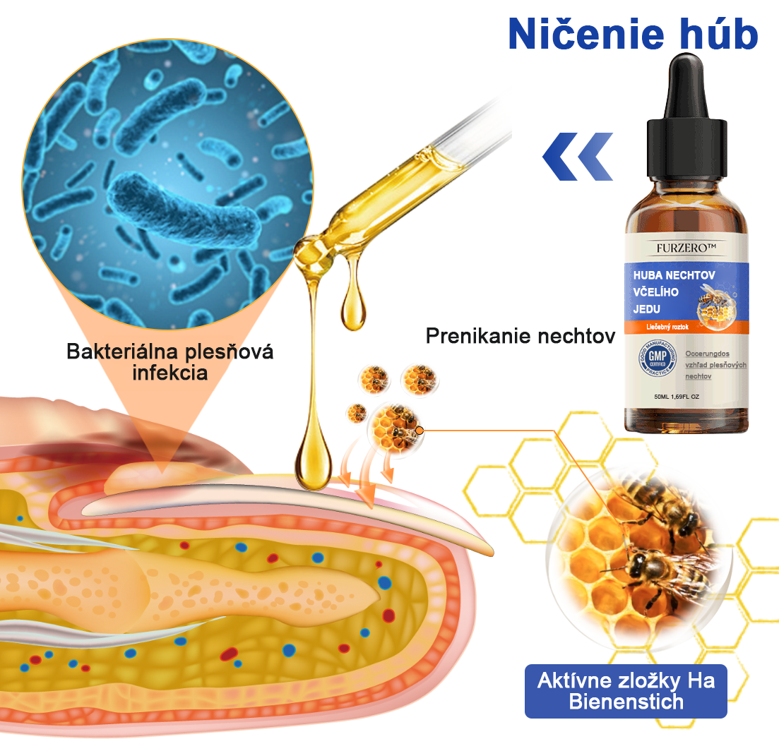 🐝🐝🐝Furzero™ Včelí jed na plesne na nechtoch: kompletné riešenie plesní na nechtoch 🌟👣