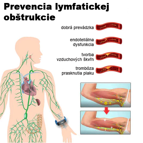🥇🌈 𝐉𝐎𝐒𝐅𝐈𝐓™ Ultrazvukový náramok na odstraňovanie celulitídy a detoxikáciu