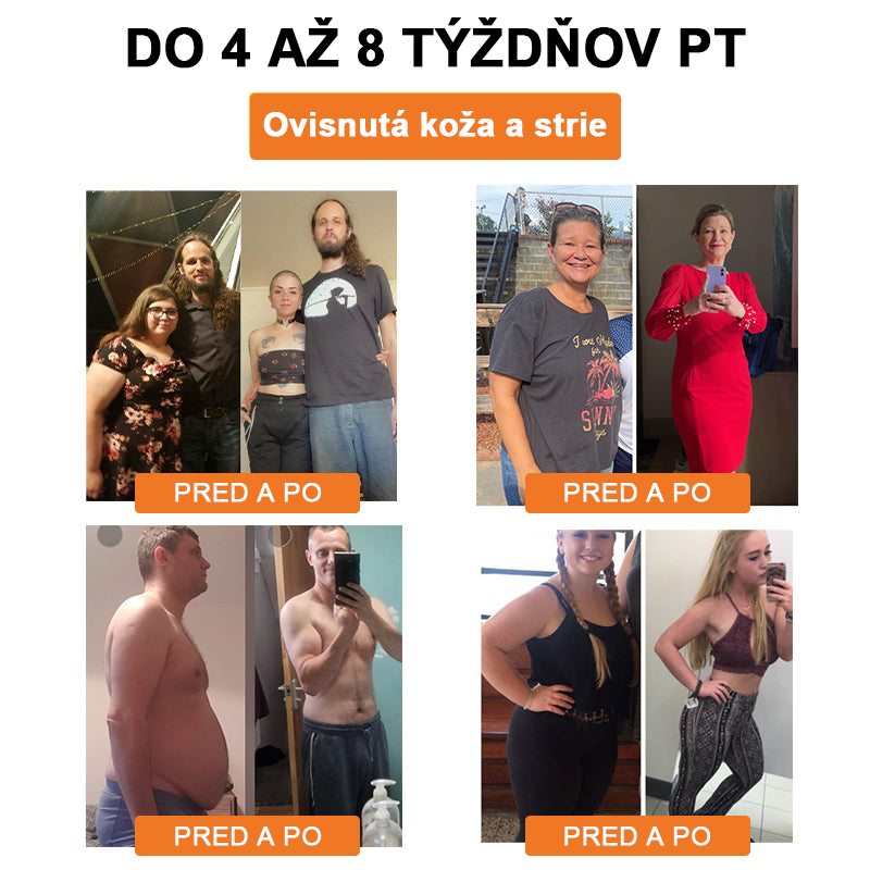 🐝Swan Bella™ Lymfodrenážna náplasť na chudnutie so včelím jedom 🔥 70% zľava na obmedzený čas 🔥 (Vhodné pre všetky vekové kategórie).