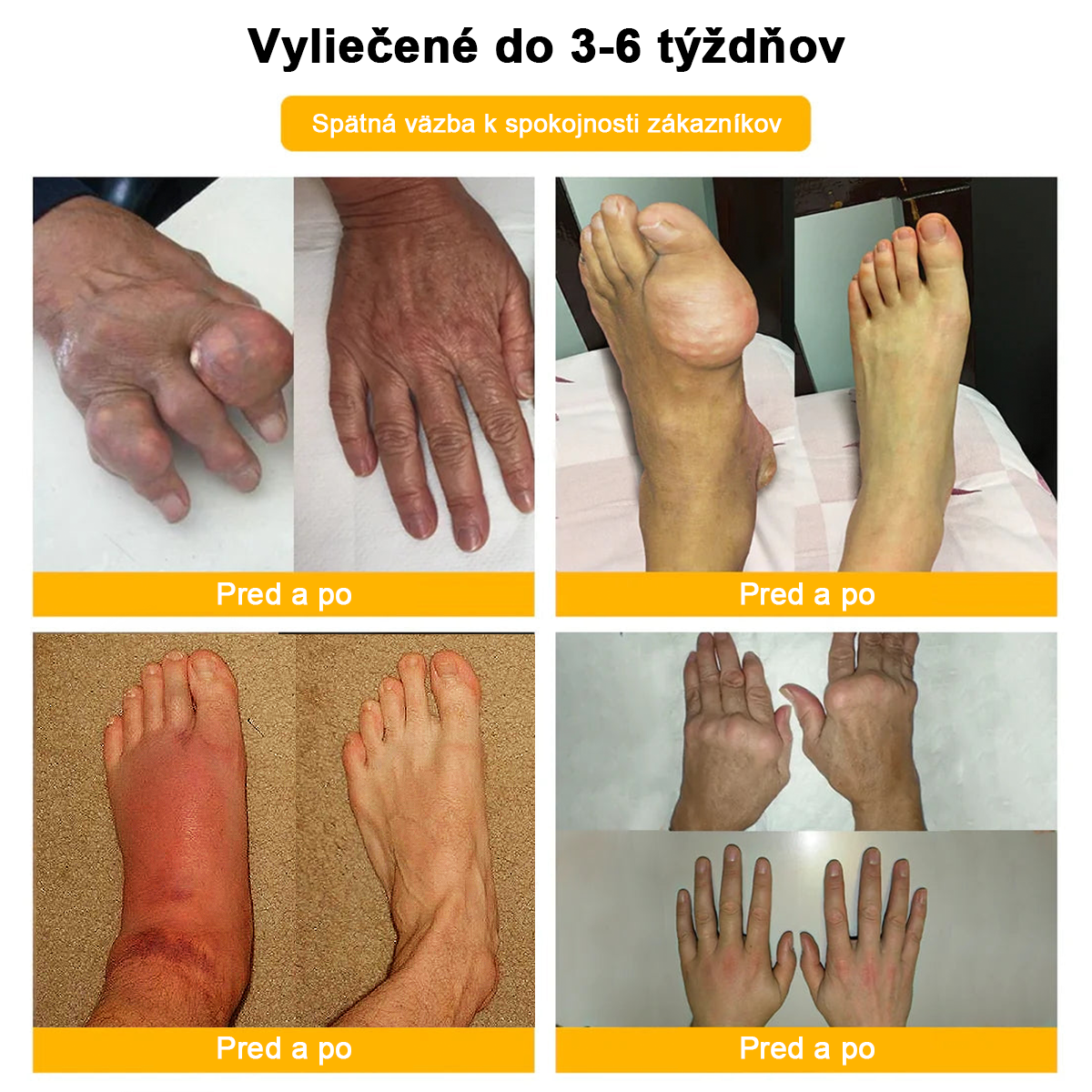 𝑭𝑨𝑻𝑶𝑵𝑮® Krém proti bolesti a hojeniu kostí zo včelieho jedu (výhradne pre seniorov a na odporúčanie NVOC)🧨