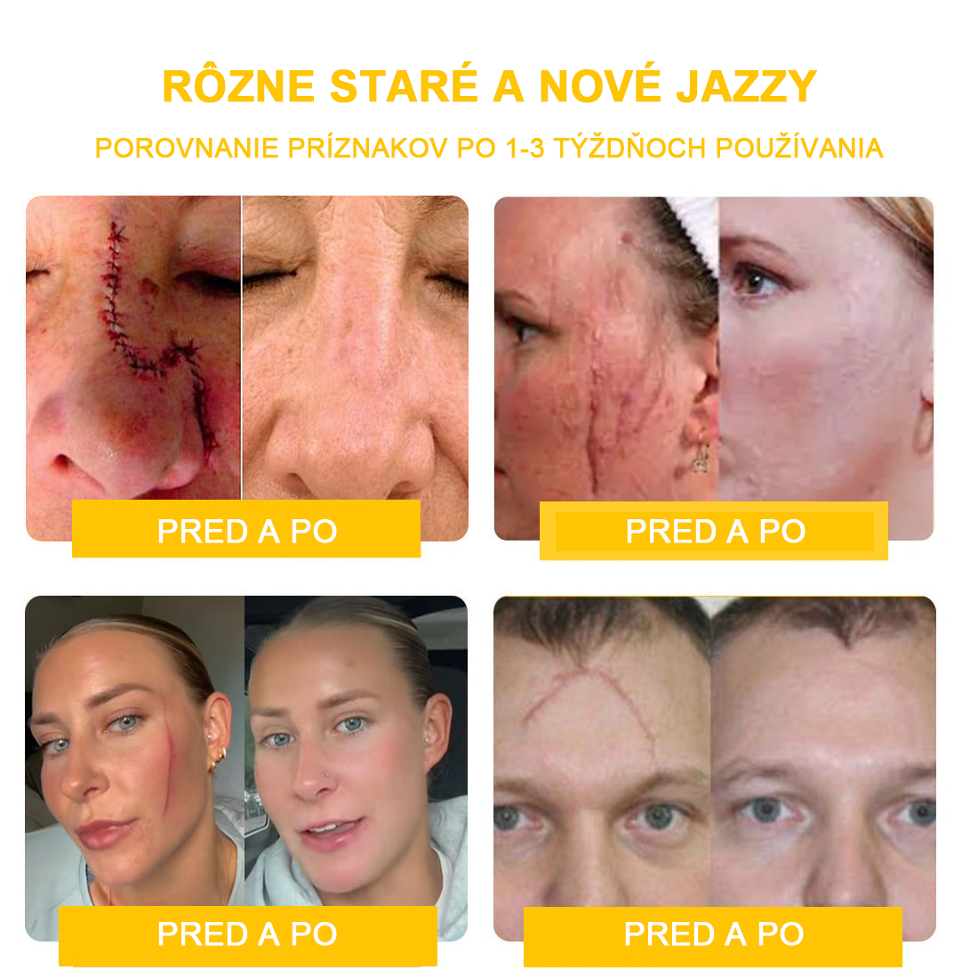 2024 NOVINKA Velisse™ Pleťový krém s včelím jedom(🧑⚕️Odporúča sa AAD), na odstránenie bradavíc, akné a jaziev – lieči viaceré kožné stavy