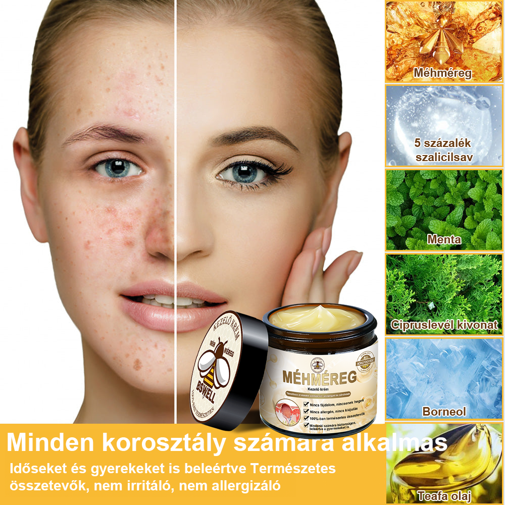 🐝BSWELL® Krém na ošetrenie včelím jedom👨⚕️(MDT recommended) (🔥Posledný deň akcie 80% zľava)