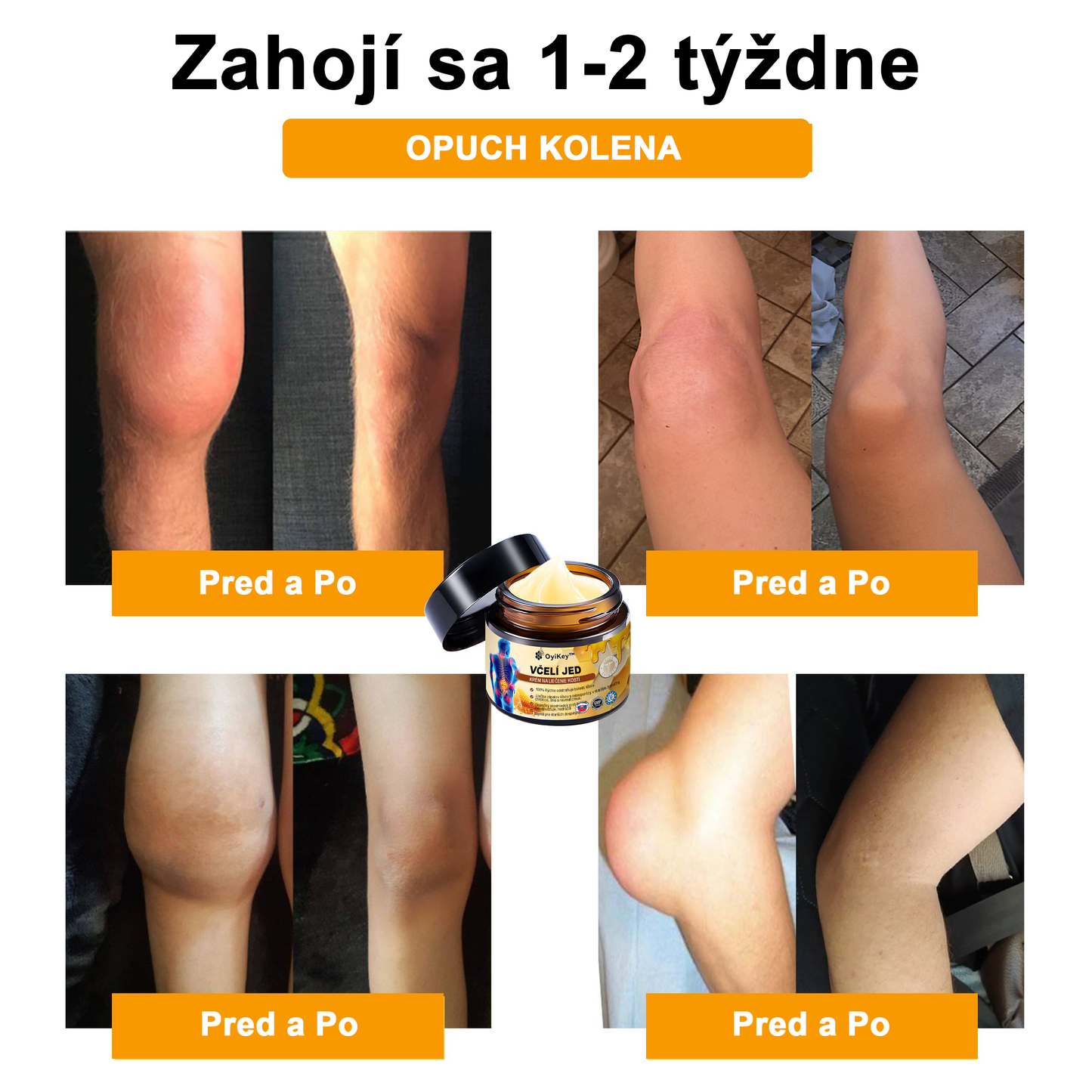 【Oficiálny obchod】 𝗔𝗲𝘁𝗵𝗲𝗿𝗶𝘀™ Včelí jed Ultra Krém na úľavu od bolesti-(Poskytuje odstránenie bolesti pri artritíde, bolesti svalov, chrbta, kolien, chrbta, ramien, bokov, zápästí, rúk)