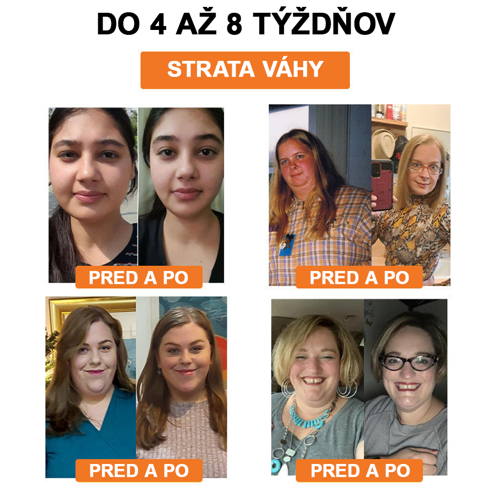 🐝Swan Bella™ Lymfodrenážna náplasť na chudnutie so včelím jedom 🔥 70% zľava na obmedzený čas 🔥 (Vhodné pre všetky vekové kategórie).