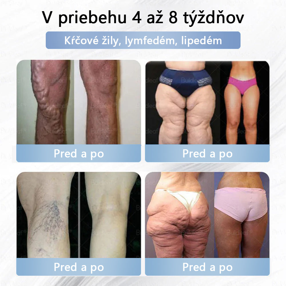 Croaie® Nano mikročlánkové náplasti so SMGT-GLP-1 a Matrixyl 3000 – chudnutie,👨⚕️👨⚕️ spevnenie pokožky, podpora hladiny cukru v krvi, bez injekcií, výsledky za 7 dní🔥