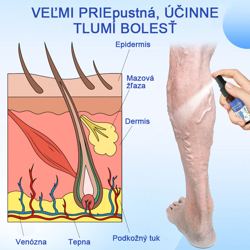 🌱🌠✨Sprej na liečbu kŕčových žíl Veinhealing™🌿