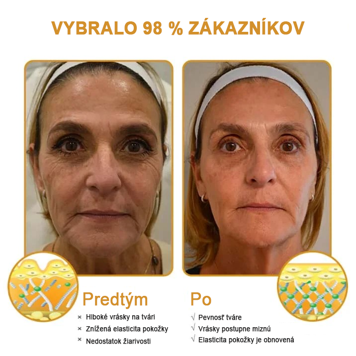 🍀Posledný deň akcie: 70% zľava - ✨Furzero™ Botoxový krém na odstránenie vrások od včelieho jedu