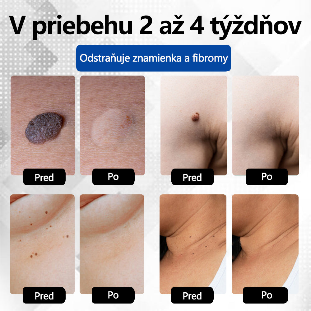 RICPIND® Multifunkčné laserové pero na opravy
