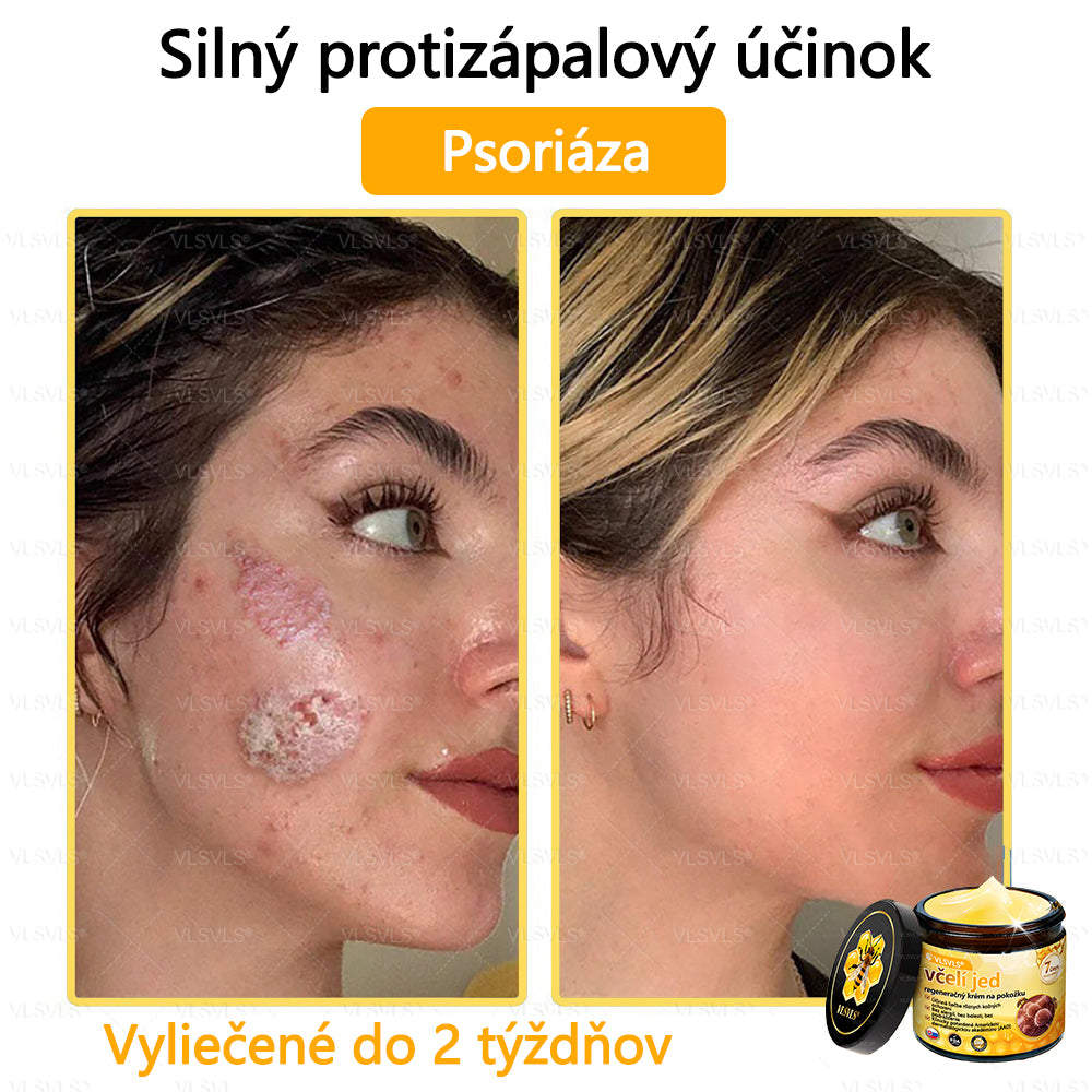 VLSVLS™ Obnovujúci krém na pleť so včelím jedom💥💥💥
