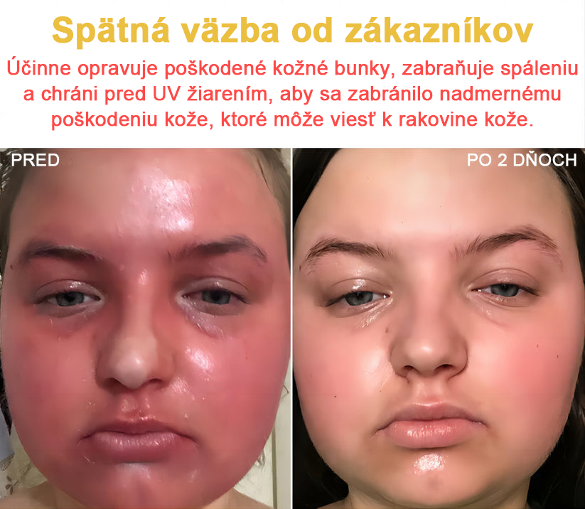 2024 NOVINKA Velisse™ Pleťový krém s včelím jedom(🧑⚕️Odporúča sa AAD), na odstránenie bradavíc, akné a jaziev – lieči viaceré kožné stavy