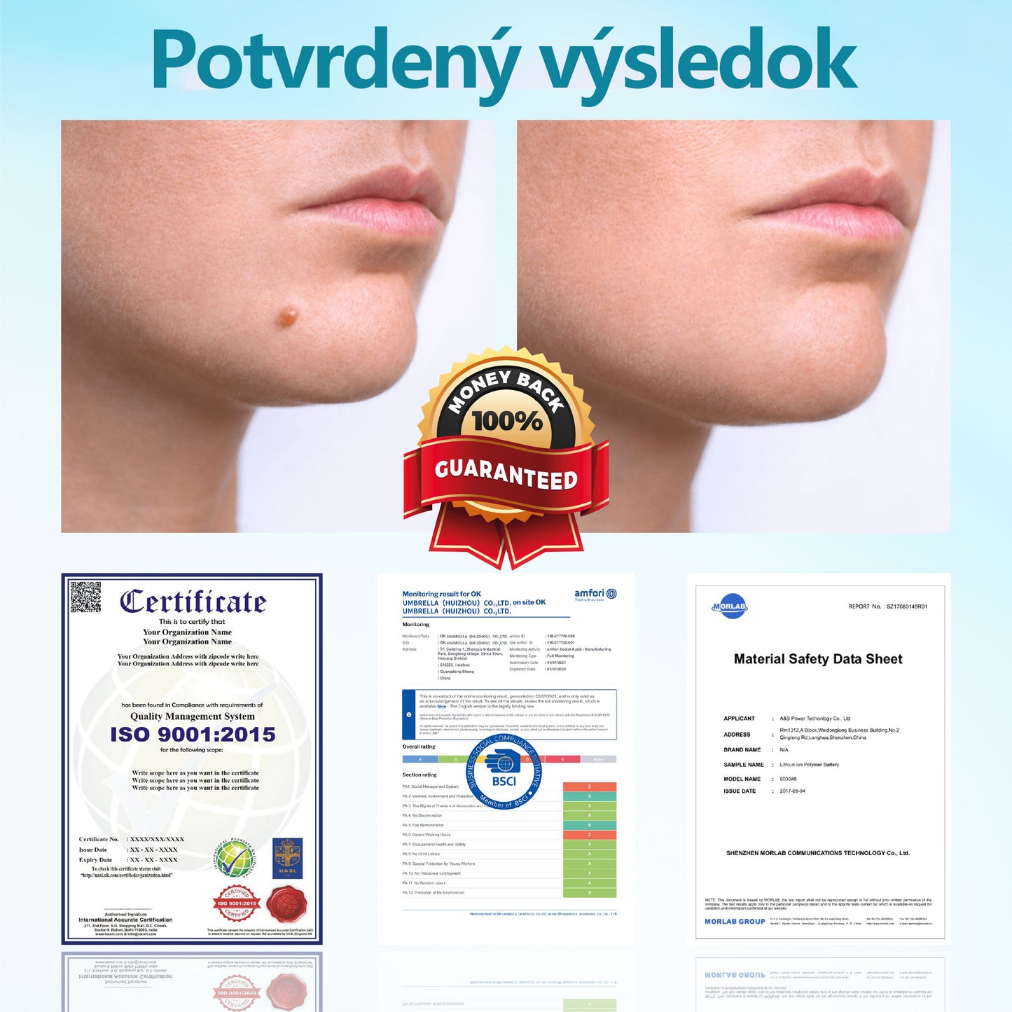 RICPIND® Multifunkčné laserové pero na opravy