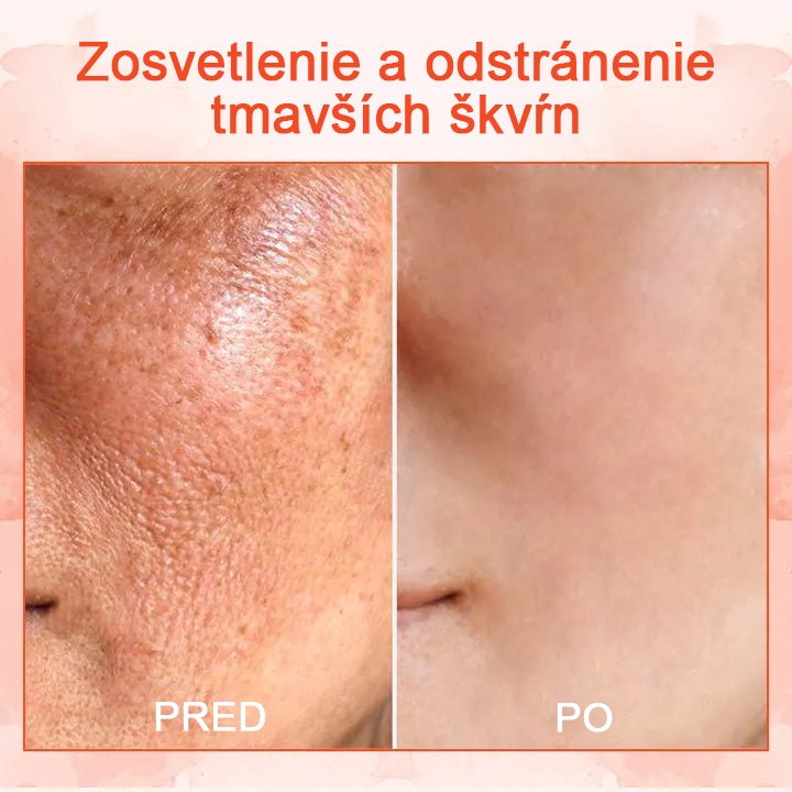 🌠✨75% zľava ✨𝗖𝗼𝗼𝗹𝗼𝗿𝗱® - 𝐋𝐮𝐱𝐞𝐋𝐢𝐟𝐭 Spevňujúci a tonizujúci telový krém✨