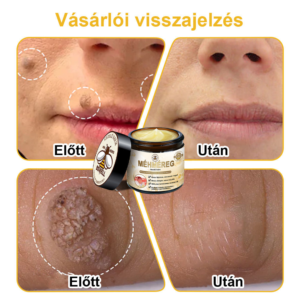 🐝BSWELL® Krém na ošetrenie včelím jedom👨⚕️(MDT recommended) (🔥Posledný deň akcie 80% zľava)