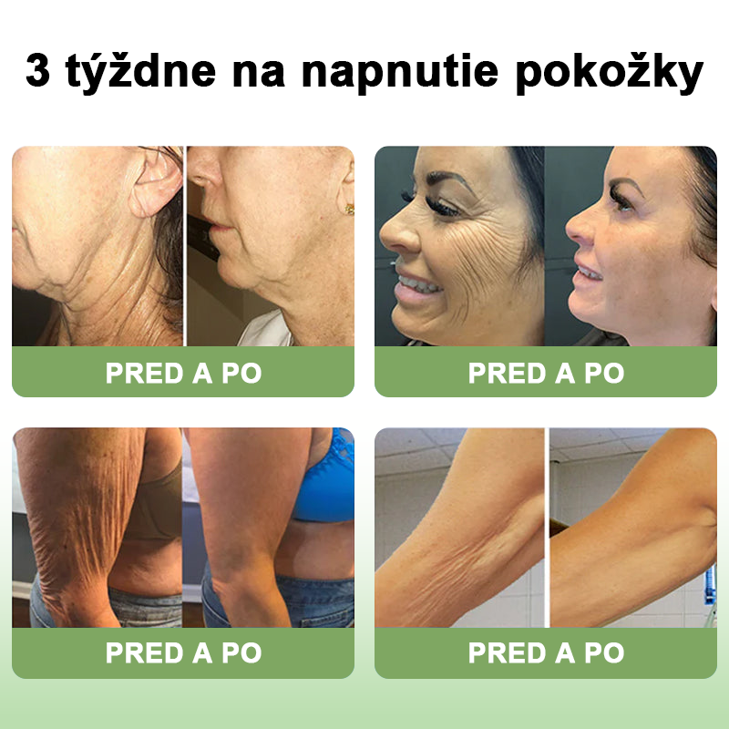 𝐒𝐓𝐃𝐄𝐈™ Kolagénový spevňujúci krém (🔥Časovo obmedzená zľava 74%!) 🏆