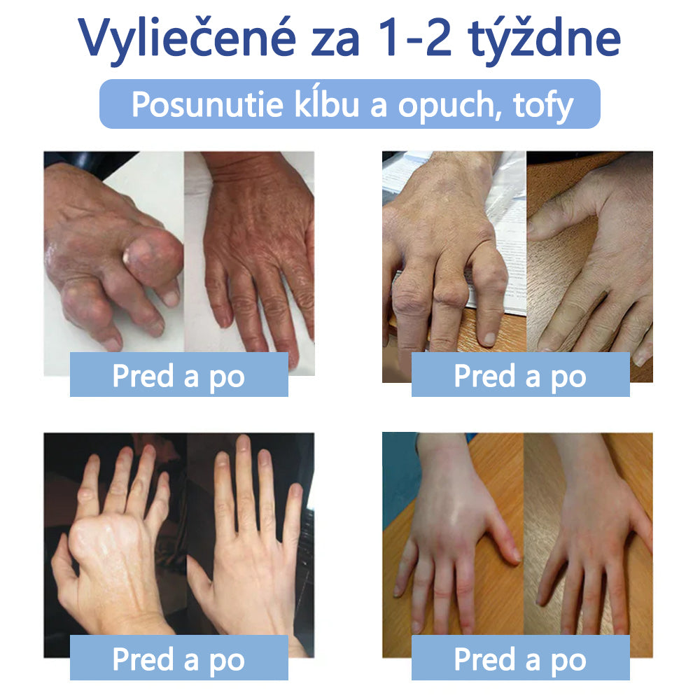 ✅ Schválené ÚVZ SR: Ourlyard® Magnéziový krém na hojenie bolesti kostí (liečba artritídy, neuropatie, reumatických ochorení, svalových kŕčov, zášklbov a športových zranení)