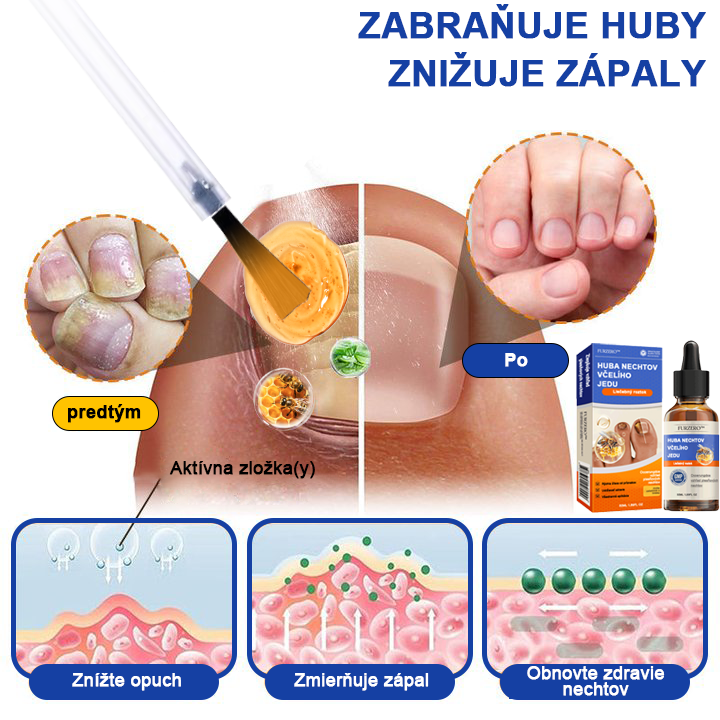 🐝🐝🐝Furzero™ Včelí jed na plesne na nechtoch: kompletné riešenie plesní na nechtoch 🌟👣