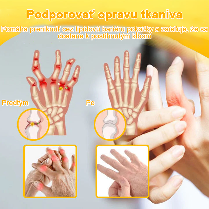 𝑭𝑨𝑻𝑶𝑵𝑮® Krém proti bolesti a hojeniu kostí zo včelieho jedu (výhradne pre seniorov a na odporúčanie NVOC)🧨