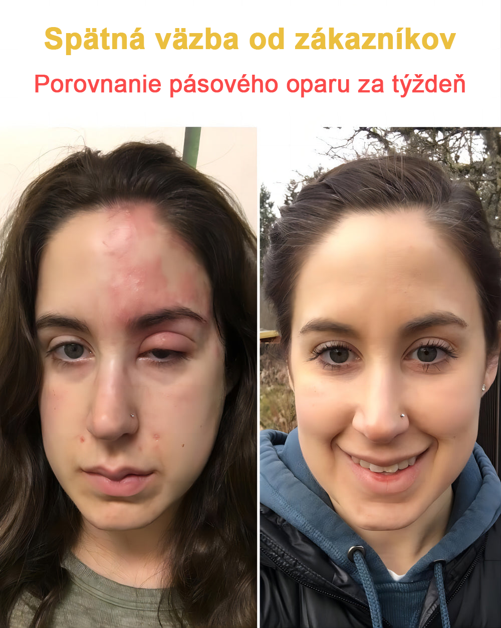 2024 NOVINKA Velisse™ Pleťový krém s včelím jedom(🧑⚕️Odporúča sa AAD), na odstránenie bradavíc, akné a jaziev – lieči viaceré kožné stavy