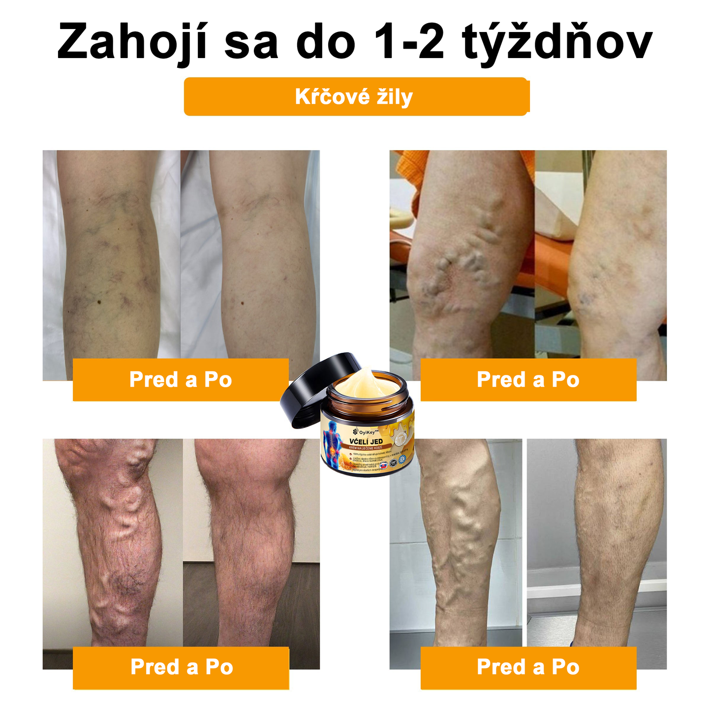 【Oficiálny obchod】 𝗔𝗲𝘁𝗵𝗲𝗿𝗶𝘀™ Včelí jed Ultra Krém na úľavu od bolesti-(Poskytuje odstránenie bolesti pri artritíde, bolesti svalov, chrbta, kolien, chrbta, ramien, bokov, zápästí, rúk)