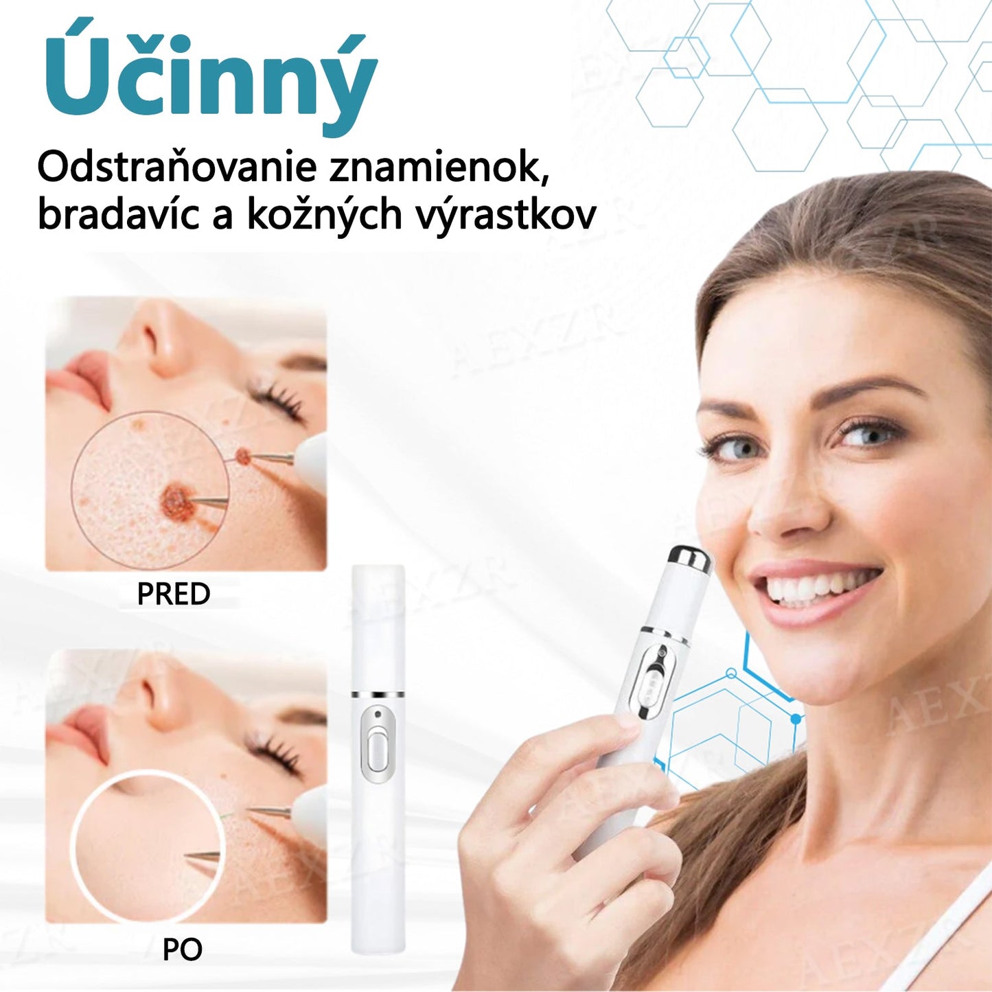 Bikenda® Neinvazívne laserové pero na odstránenie znamienok a bradavíc💥