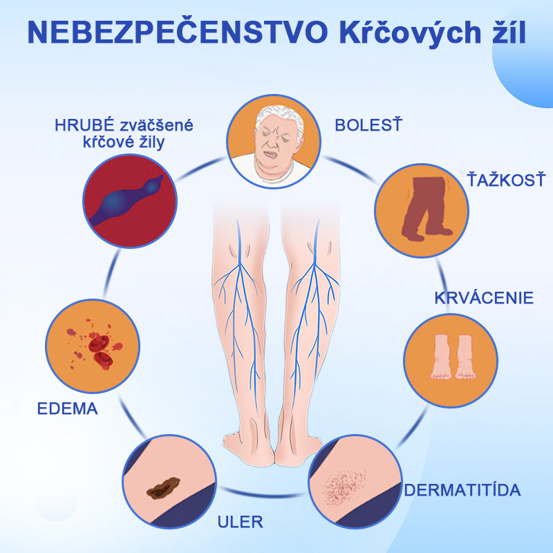🌱🌠✨Sprej na liečbu kŕčových žíl Veinhealing™🌿