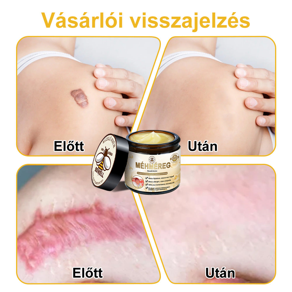 🐝BSWELL® Krém na ošetrenie včelím jedom👨⚕️(MDT recommended) (🔥Posledný deň akcie 80% zľava)