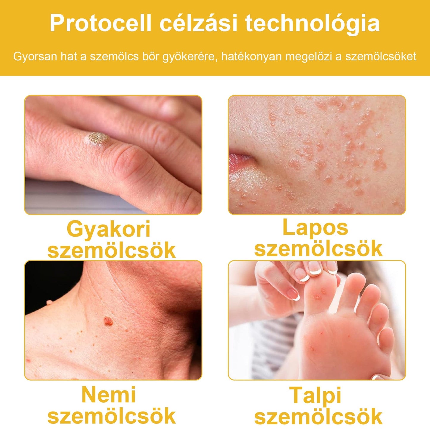 🐝BSWELL® Krém na ošetrenie včelím jedom👨⚕️(MDT recommended) (🔥Posledný deň akcie 80% zľava)