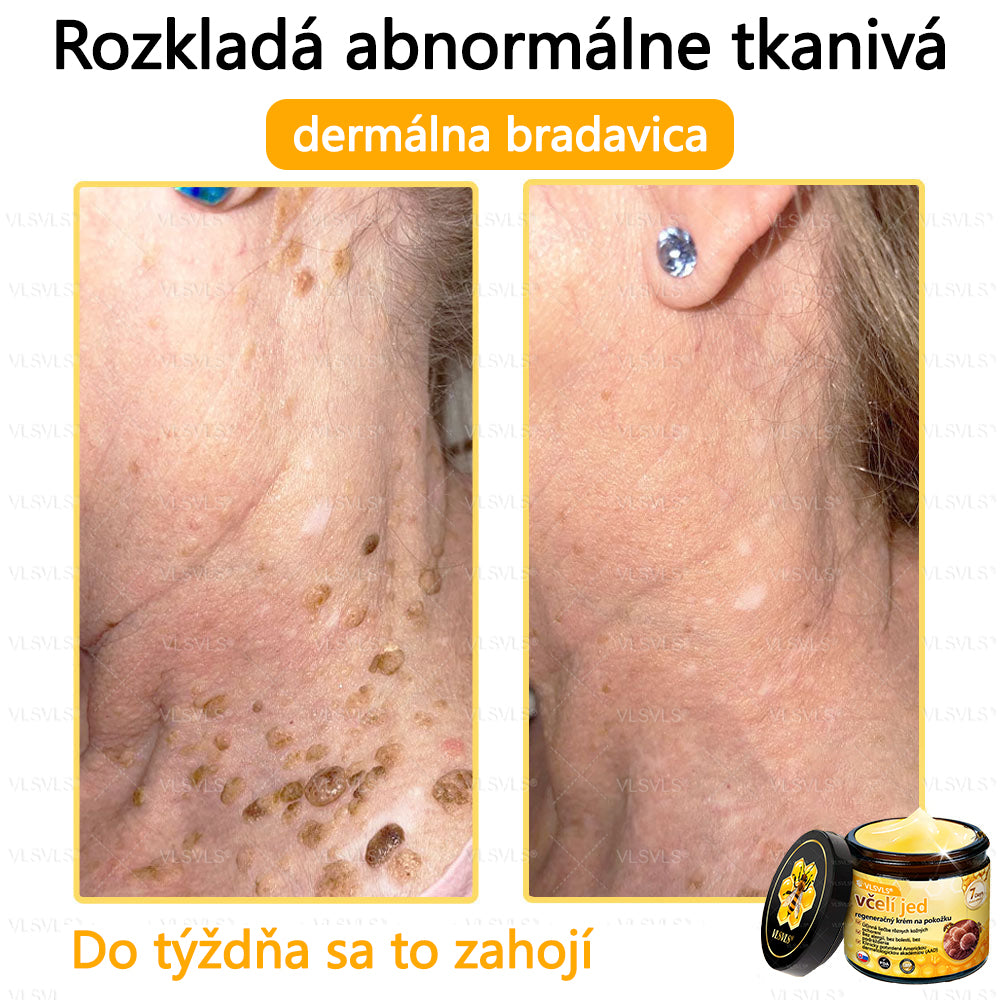 VLSVLS™ Obnovujúci krém na pleť so včelím jedom💥💥💥