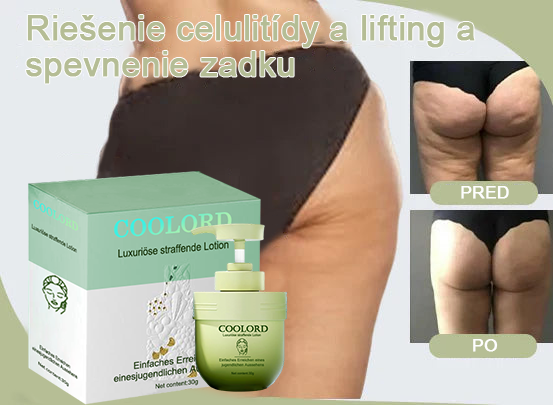 💞 Coolord™ Luxusný kolagénový spevňujúci krém (pre všetky ženy)
