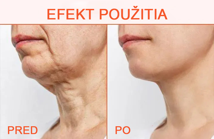 🌠✨75% zľava ✨𝗖𝗼𝗼𝗹𝗼𝗿𝗱® - 𝐋𝐮𝐱𝐞𝐋𝐢𝐟𝐭 Spevňujúci a tonizujúci telový krém✨