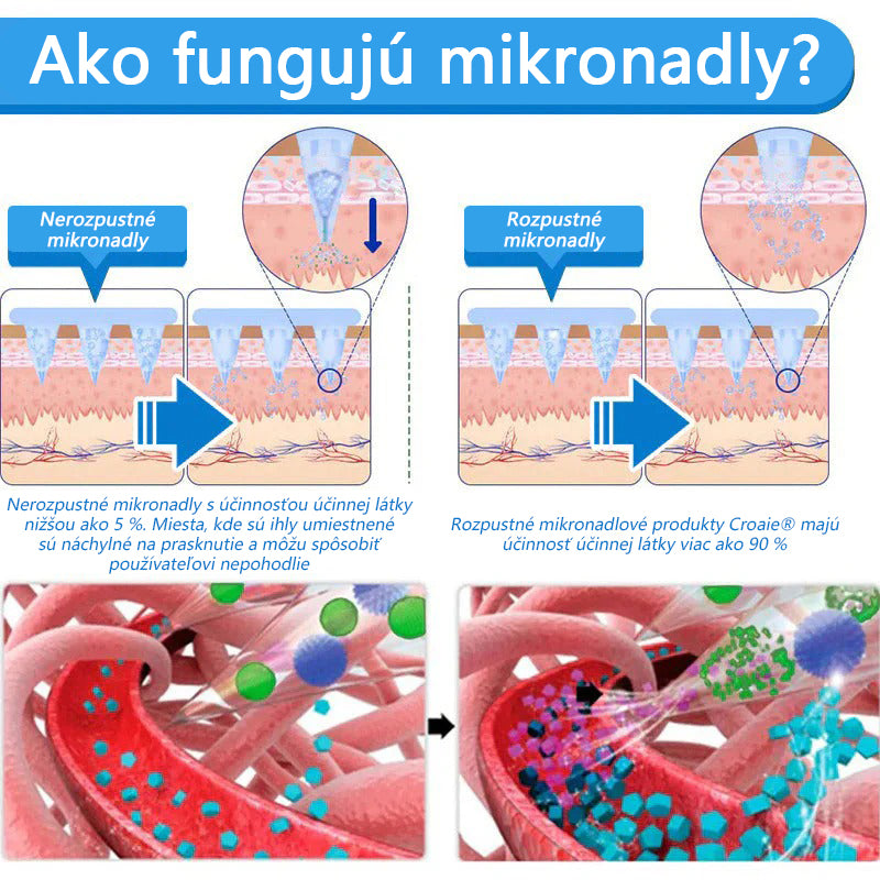 Croaie® Nano mikročlánkové náplasti so SMGT-GLP-1 a Matrixyl 3000 – chudnutie,👨⚕️👨⚕️ spevnenie pokožky, podpora hladiny cukru v krvi, bez injekcií, výsledky za 7 dní🔥