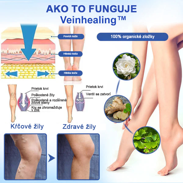 🌱🌠✨Sprej na liečbu kŕčových žíl Veinhealing™🌿