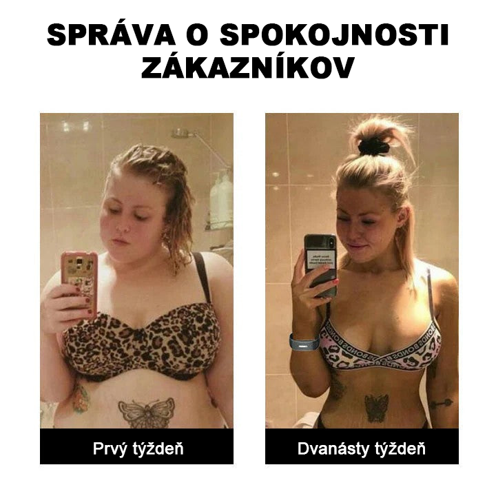🥇🌈 𝐉𝐎𝐒𝐅𝐈𝐓™ Ultrazvukový náramok na odstraňovanie celulitídy a detoxikáciu