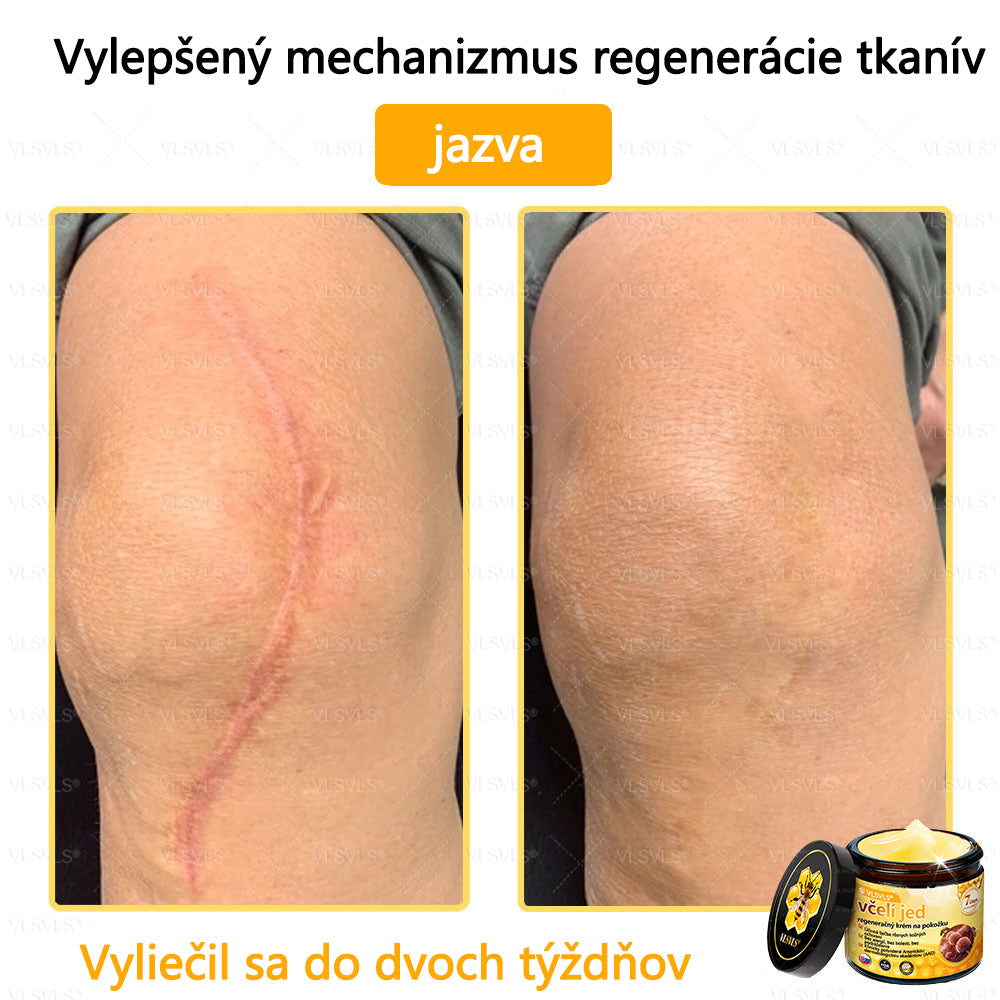 VLSVLS™ Obnovujúci krém na pleť so včelím jedom💥💥💥