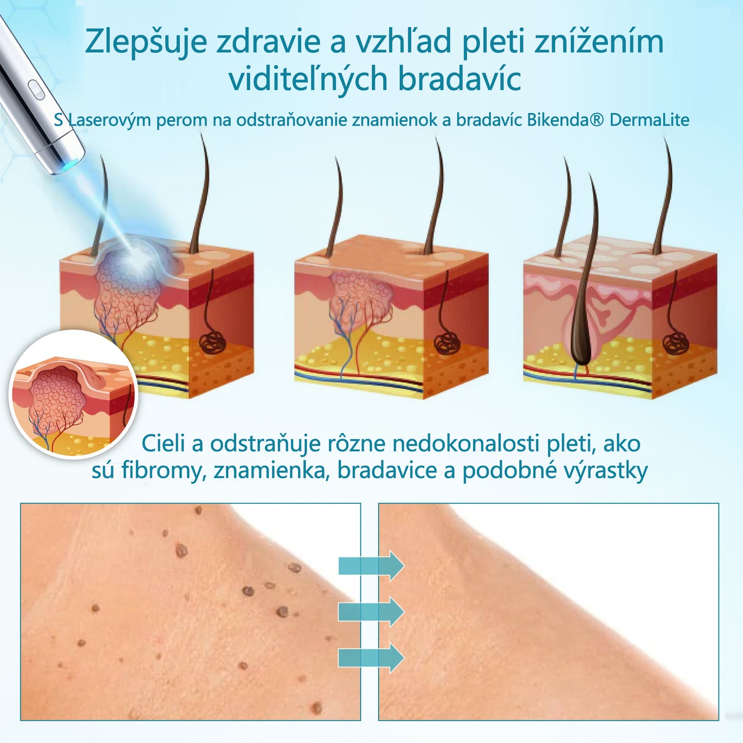 RICPIND® Multifunkčné laserové pero na opravy