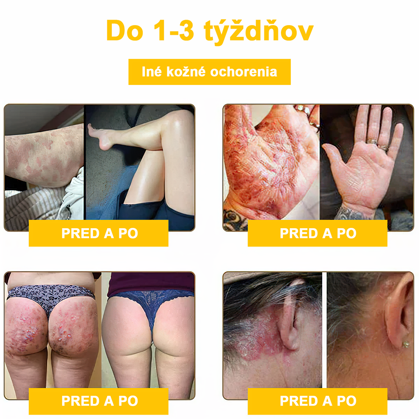 2024 NOVINKA Velisse™ Pleťový krém s včelím jedom(🧑⚕️Odporúča sa AAD), na odstránenie bradavíc, akné a jaziev – lieči viaceré kožné stavy