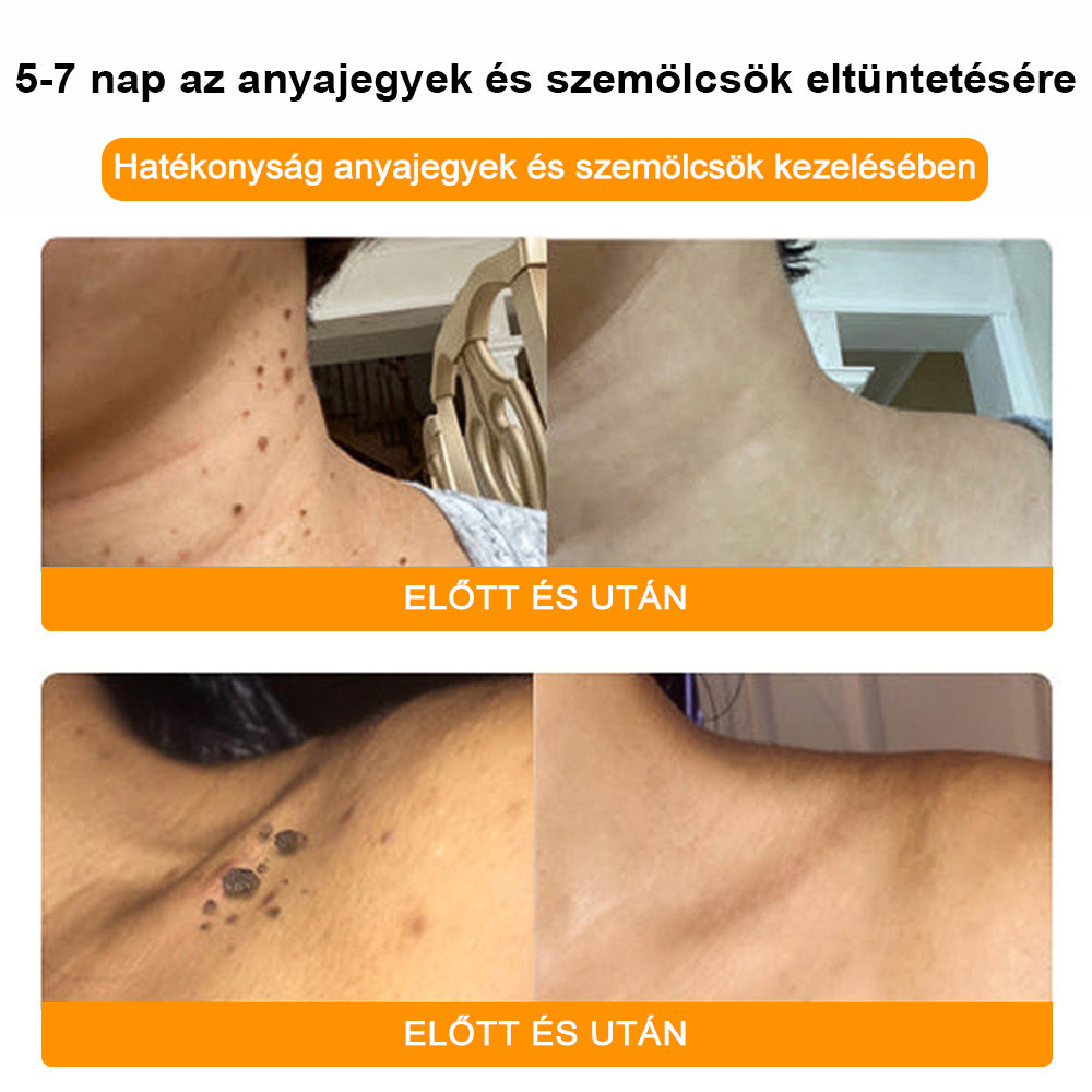 🐝BSWELL® Krém na ošetrenie včelím jedom👨⚕️(MDT recommended) (🔥Posledný deň akcie 80% zľava)