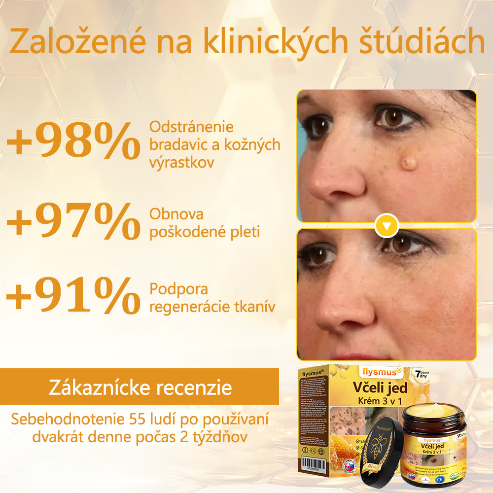 ✅flysmus® Silný krém s včelím jedom – Odporúčaný dermatologickými odborníkmi. Účinný proti bradaviciam, hrčkám, léziám, infekciám a jazvám.🐝