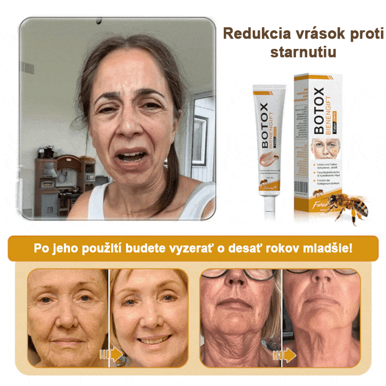 🍀Posledný deň akcie: 70% zľava - ✨Furzero™ Botoxový krém na odstránenie vrások od včelieho jedu