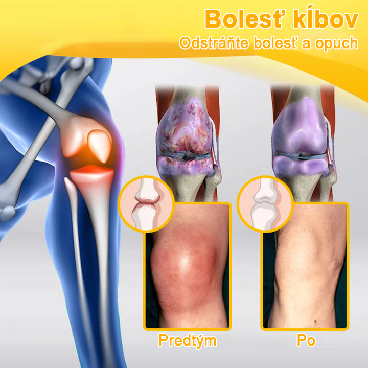 𝑭𝑨𝑻𝑶𝑵𝑮® Krém proti bolesti a hojeniu kostí zo včelieho jedu (výhradne pre seniorov a na odporúčanie NVOC)🧨
