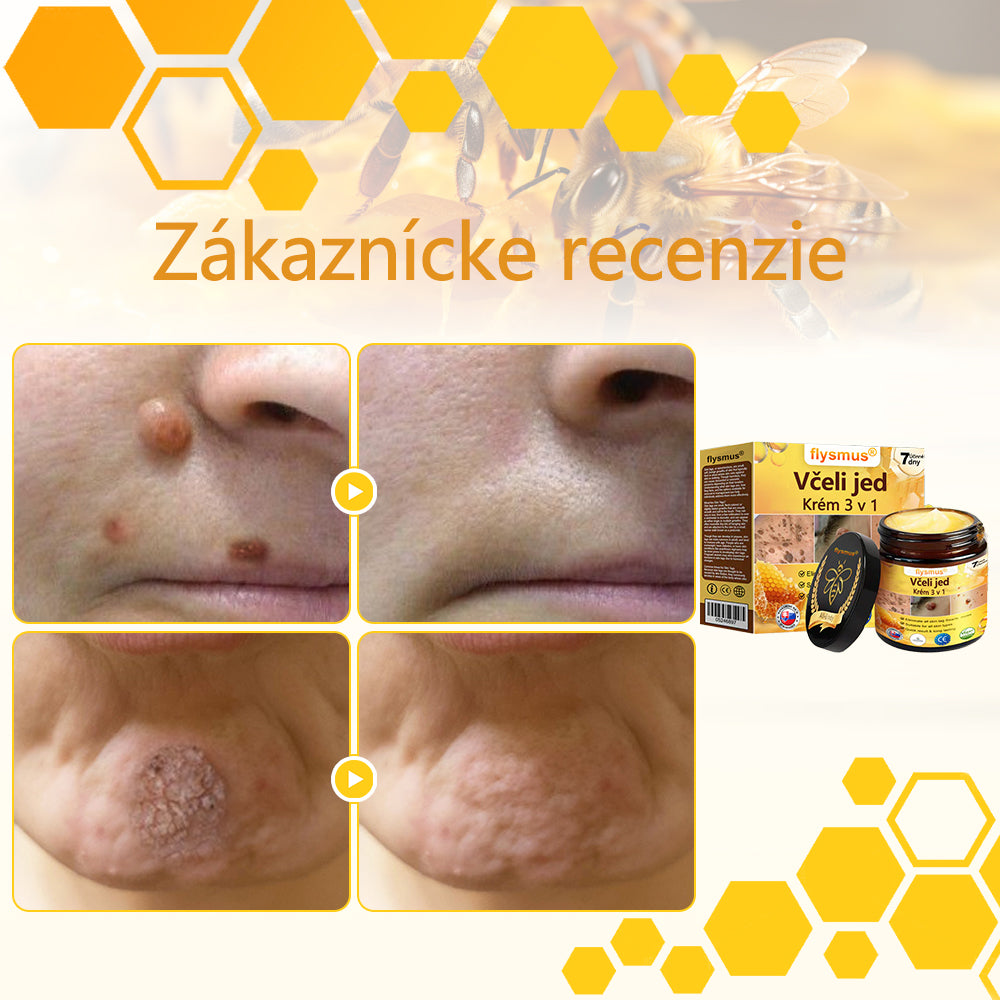 ✅flysmus® Silný krém s včelím jedom – Odporúčaný dermatologickými odborníkmi. Účinný proti bradaviciam, hrčkám, léziám, infekciám a jazvám.🐝